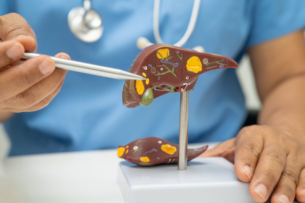 Understanding Gallstone Symptoms and Treatment Options