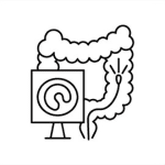 Flexible Sigmoidoscopy Graphic Image